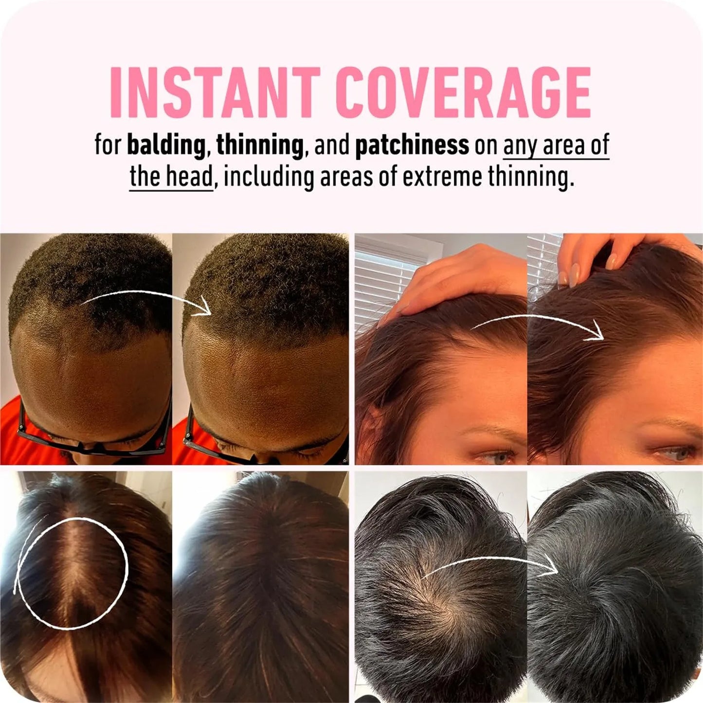 Powder Instantly Conceals Hair Loss, Root up Hair Powder, Hair Toppers for Women & Men, Hair Fibers for Thinning Hair, Gift