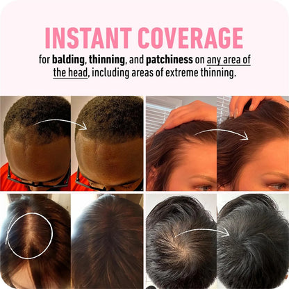 Powder Instantly Conceals Hair Loss, Root up Hair Powder, Hair Toppers for Women & Men, Hair Fibers for Thinning Hair, Gift